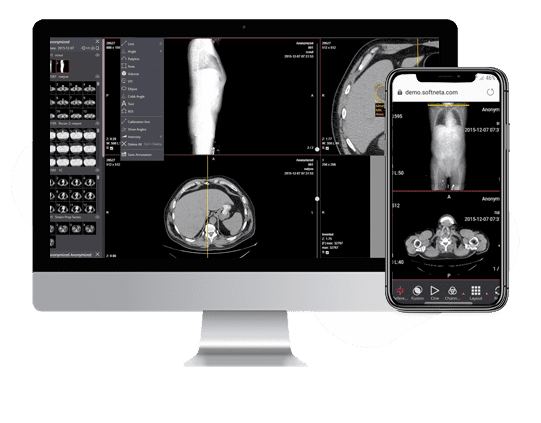 dicom-pacs-study
