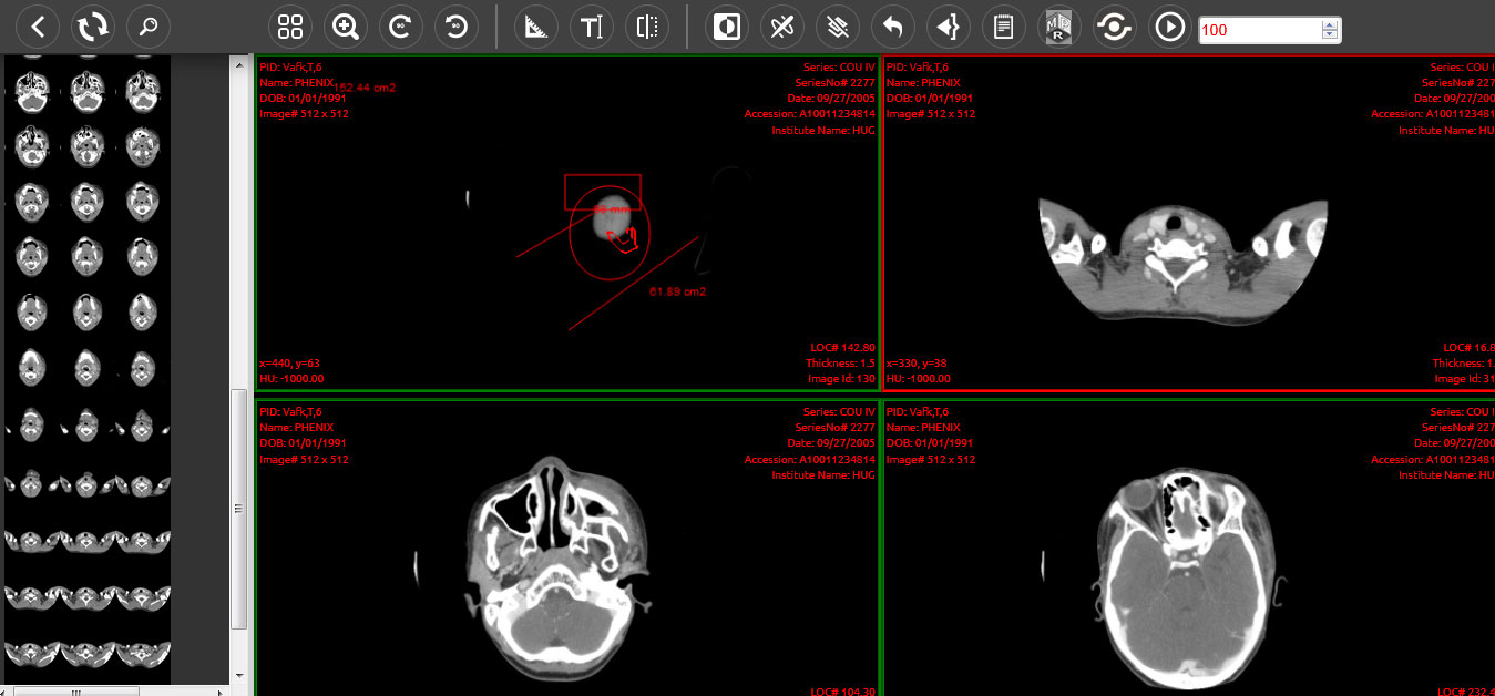 dicom1