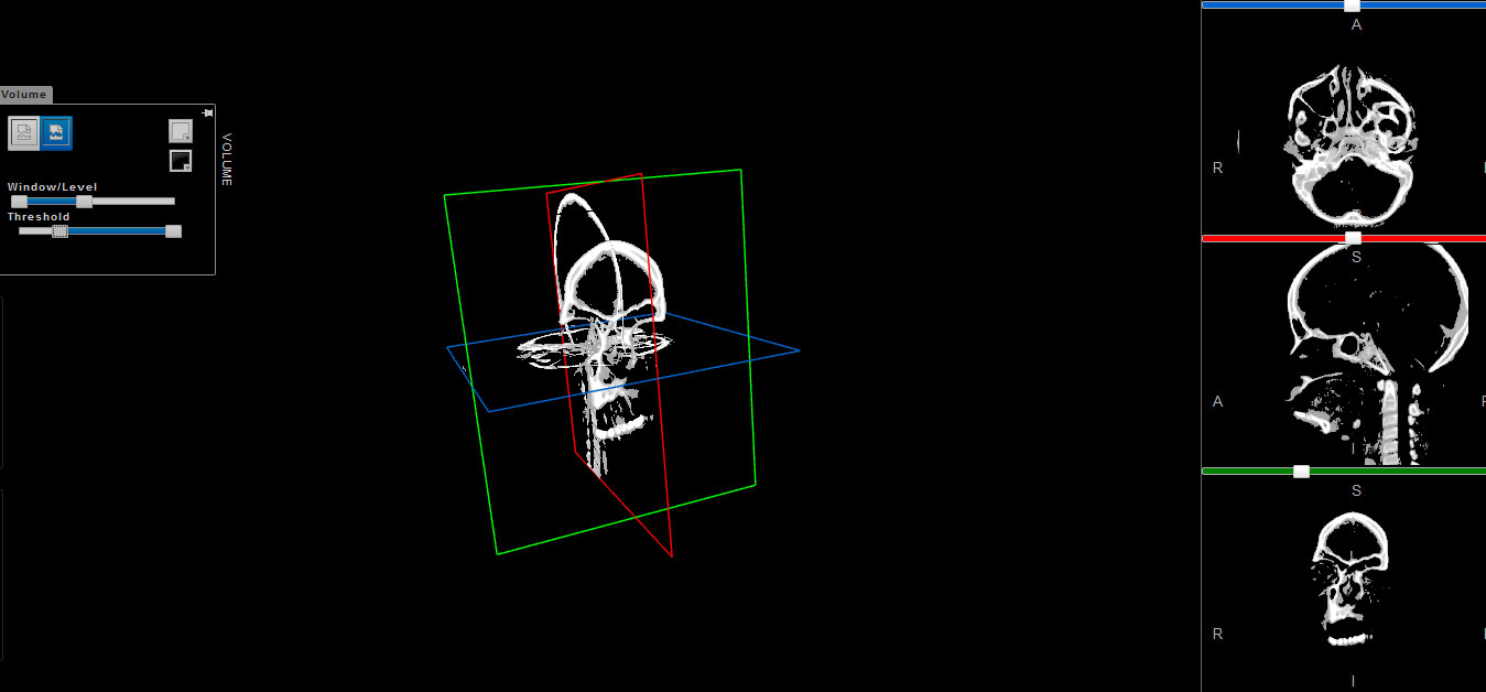 dicom2